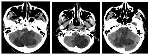 邢臺市第九醫院神經內科二區 專業守護，實績突出的神經健康守護者